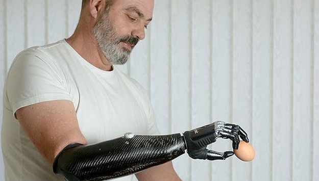Lengan bionic